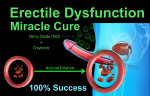 erectile dysfunction,ed cure,erectile dysfunction help,erectile,dysfunction,natural cure,impotence,erectile dysfunction cure,oxytocin,nitric oxide,healthy life style,testosterone,ed help,erctile dysfunction healing